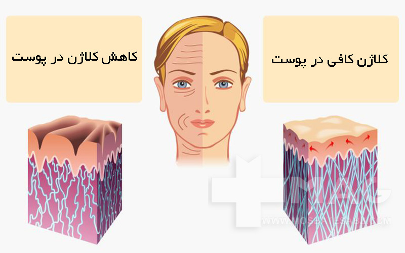 کلاژن در پوست